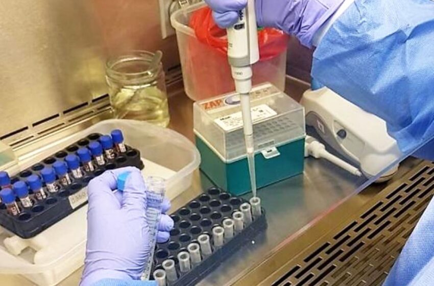 Perú y Argentina desarrollan su propia prueba molecular para COVID-19