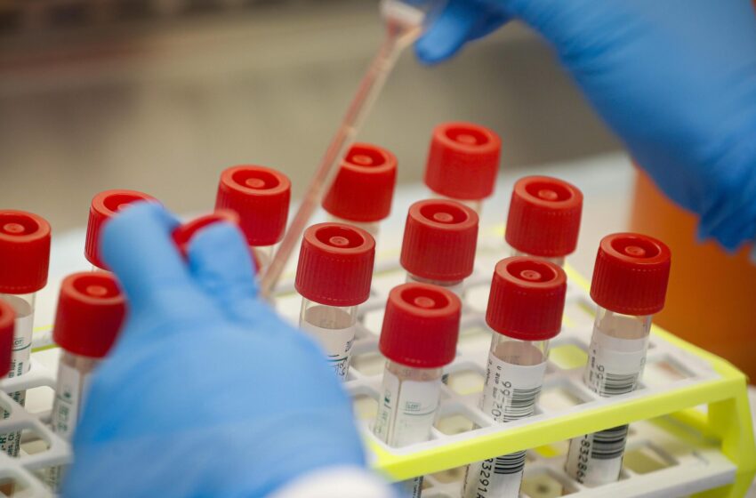  OIEA dona pruebas de diagnóstico y materiales de laboratorios a la Región Loreto