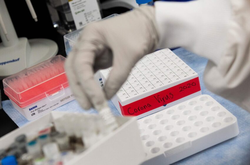  La Organización Internacional de Energía Anatómica dona al INS insumos para diagnóstico molecular de la COVID-19 en Lima e Iquitos