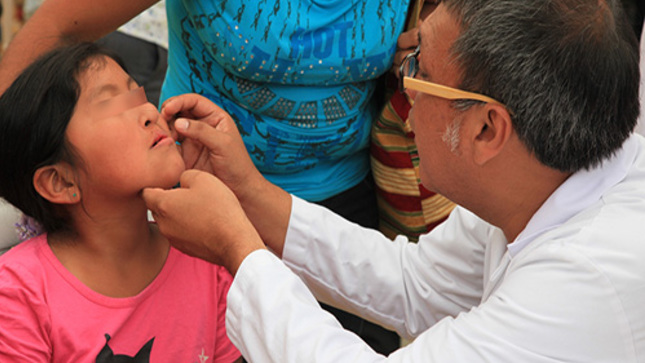  MÉDICOS NORTEAMERICANOS OPERARAN A NIÑOS CON LABIO LEPORINO Y PALADAR HENDIDO EN HOSPITAL DOS DE MAYO
